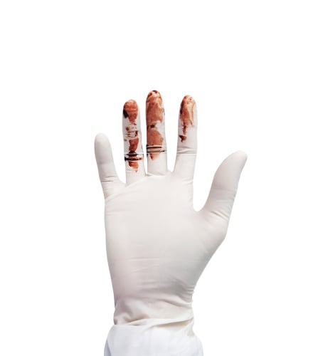 latex gloves with blood on fingers
